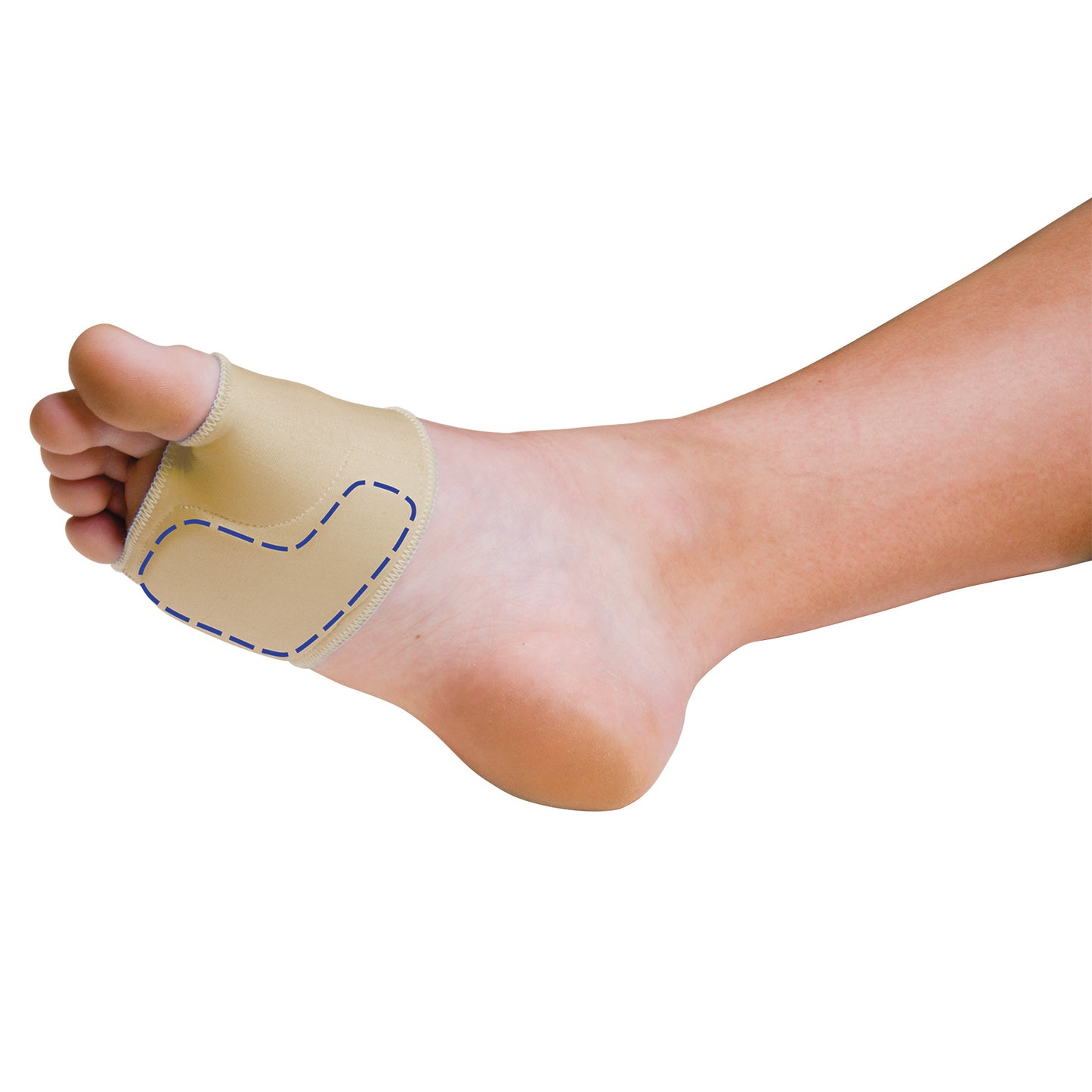 A foot wearing a PediFix Sesamoid Relief Sleeve designed to cushion and support the big toe joint area, featuring a beige fabric.