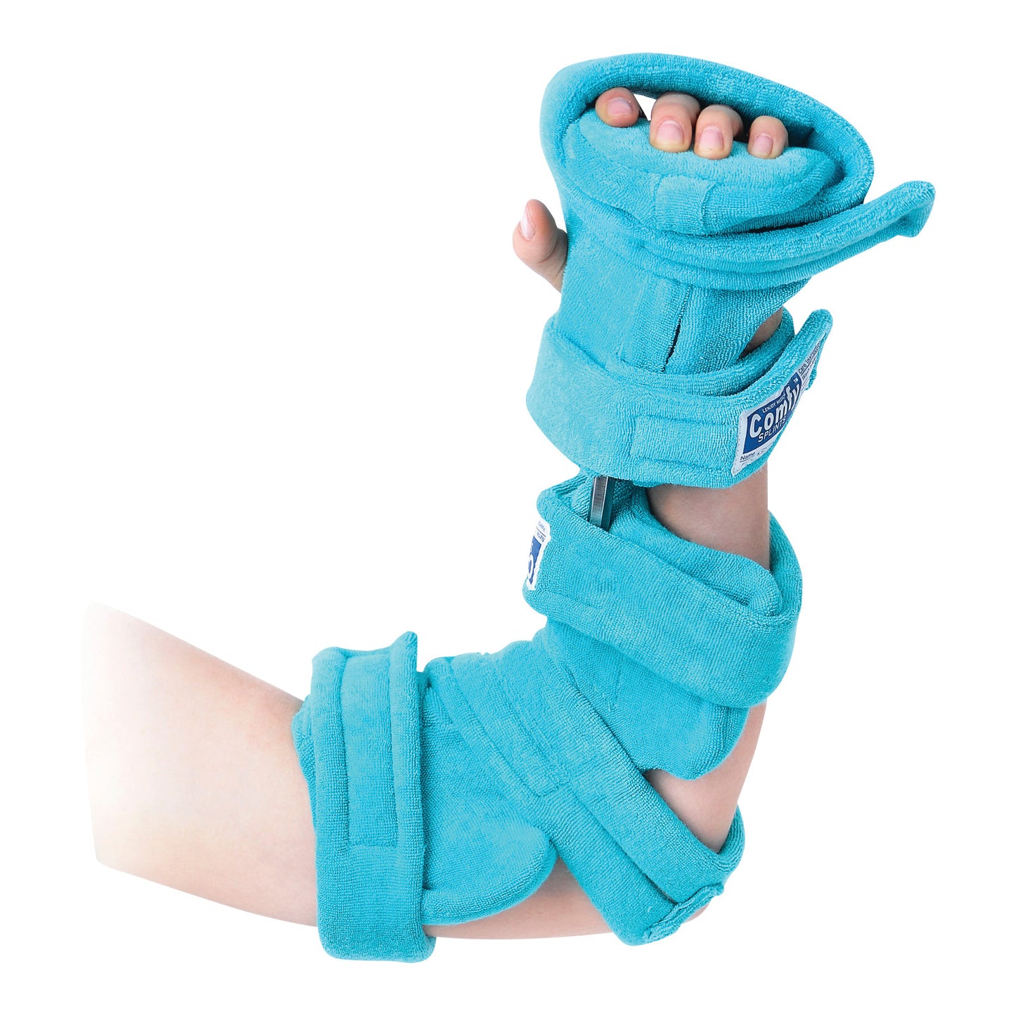 A child's arm is in a Comfy Splints Pediatric Spring-Loaded Goniometer Elbow and Full Hand Orthosis, which is bright blue and padded.