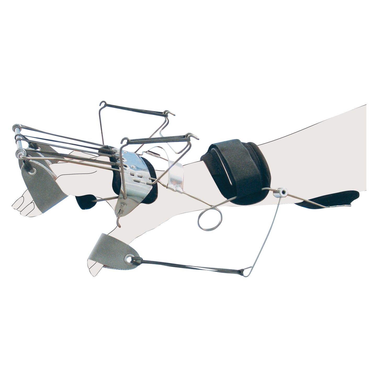 A Combination Spring Oppenheimer with Reverse Knuckle Bender splint is fitted on a forearm to aid finger extension using metal wires.