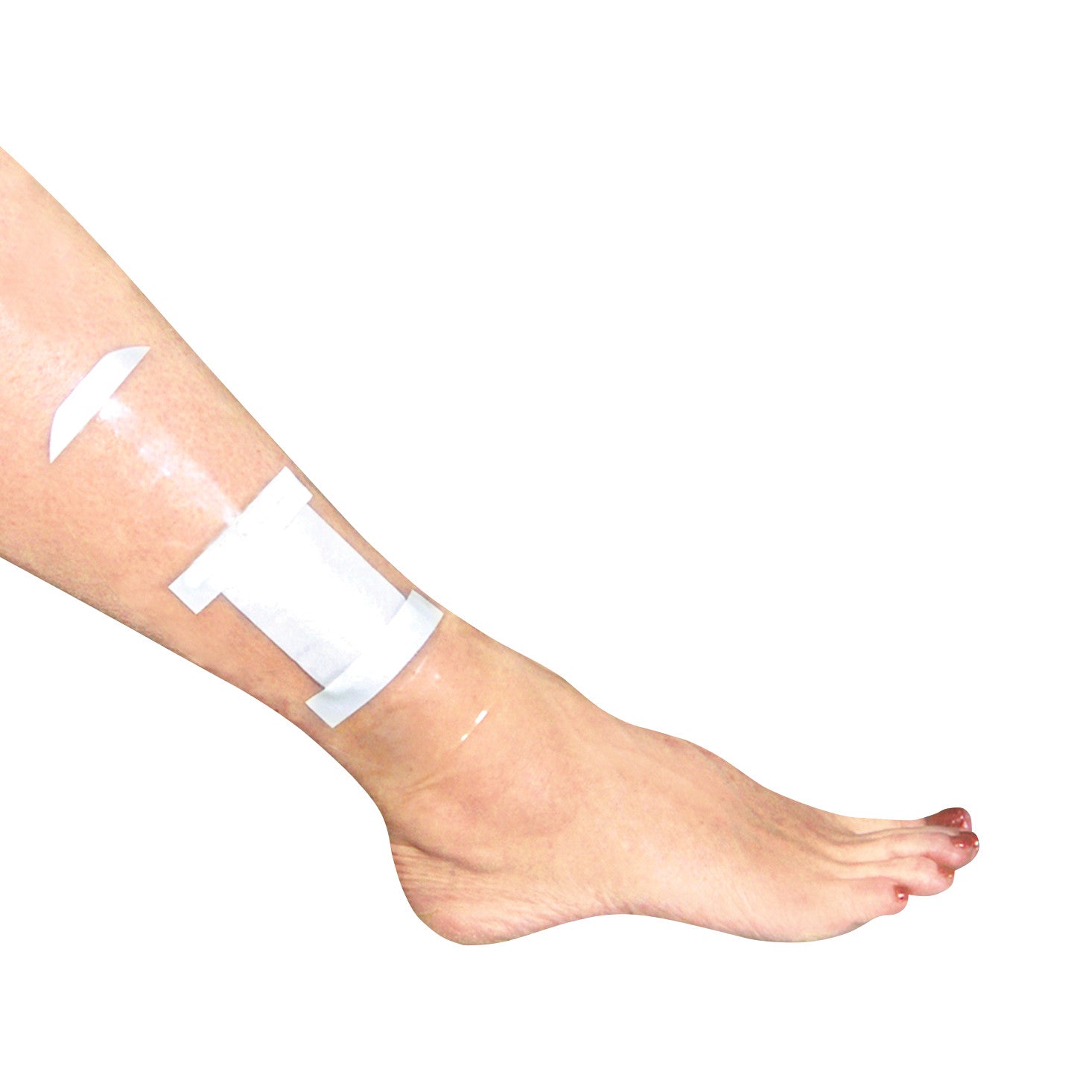 A leg wearing the Brownmed SEAL-TIGHT Shield, a clear waterproof cover over a white bandage with adhesive strips.