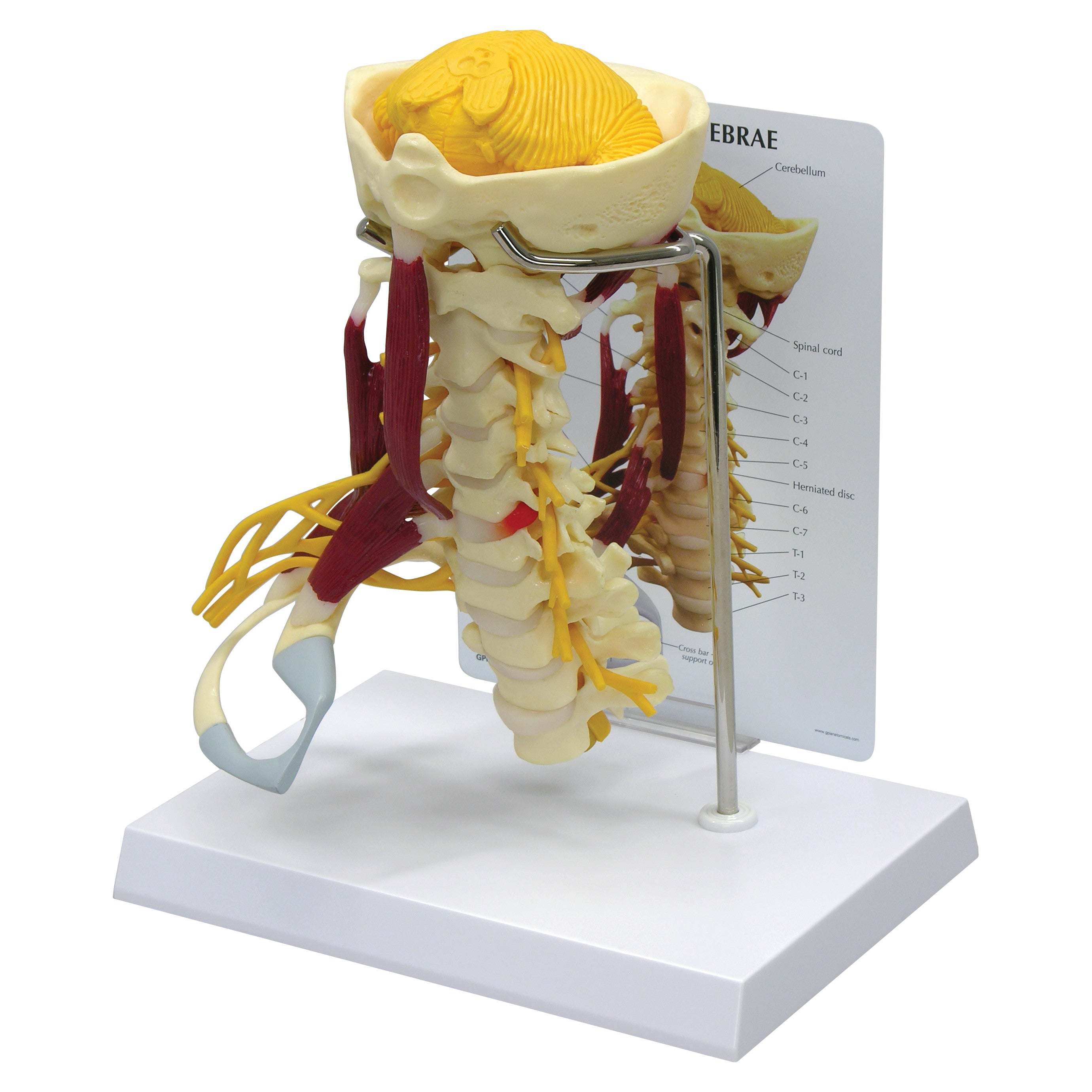 GPI Anatomicals Muscled Cervical Model displays a detailed cervical spine with muscles, nerves, and a brain on a stand for educational purposes.