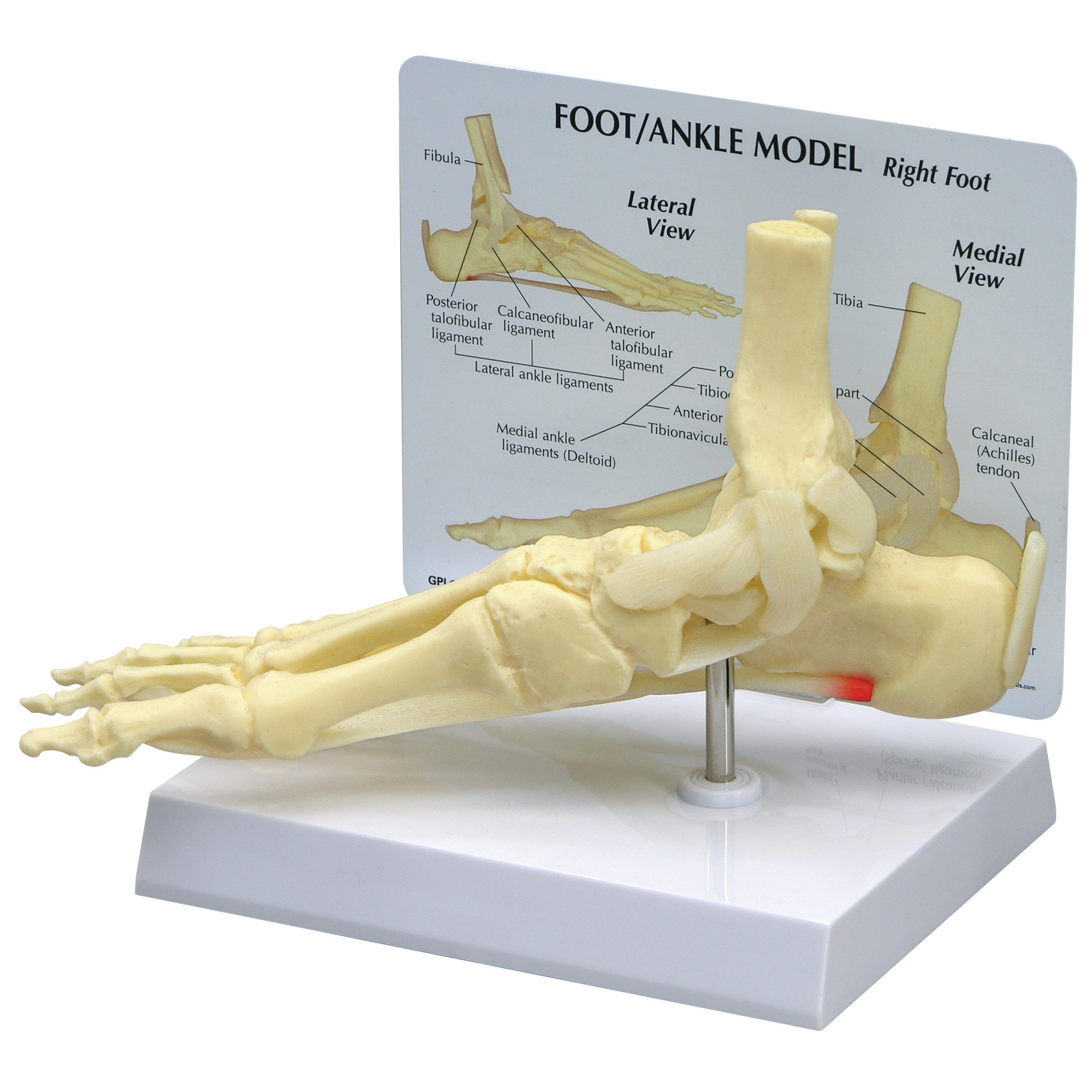 GPI Anatomicals Foot/Ankle Plantar Fasciitis Model displays a right foot's skeletal structure with labeled diagrams of ligaments.