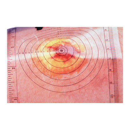 The Disposable Wound Measuring Guide is placed on skin showing a circular wound, with measurement scales on two sides.