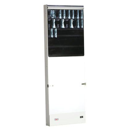 The Wolf Trimline Spinal 36 Illuminator displays multiple spinal X-rays in a vertical lightbox with a white and black frame.