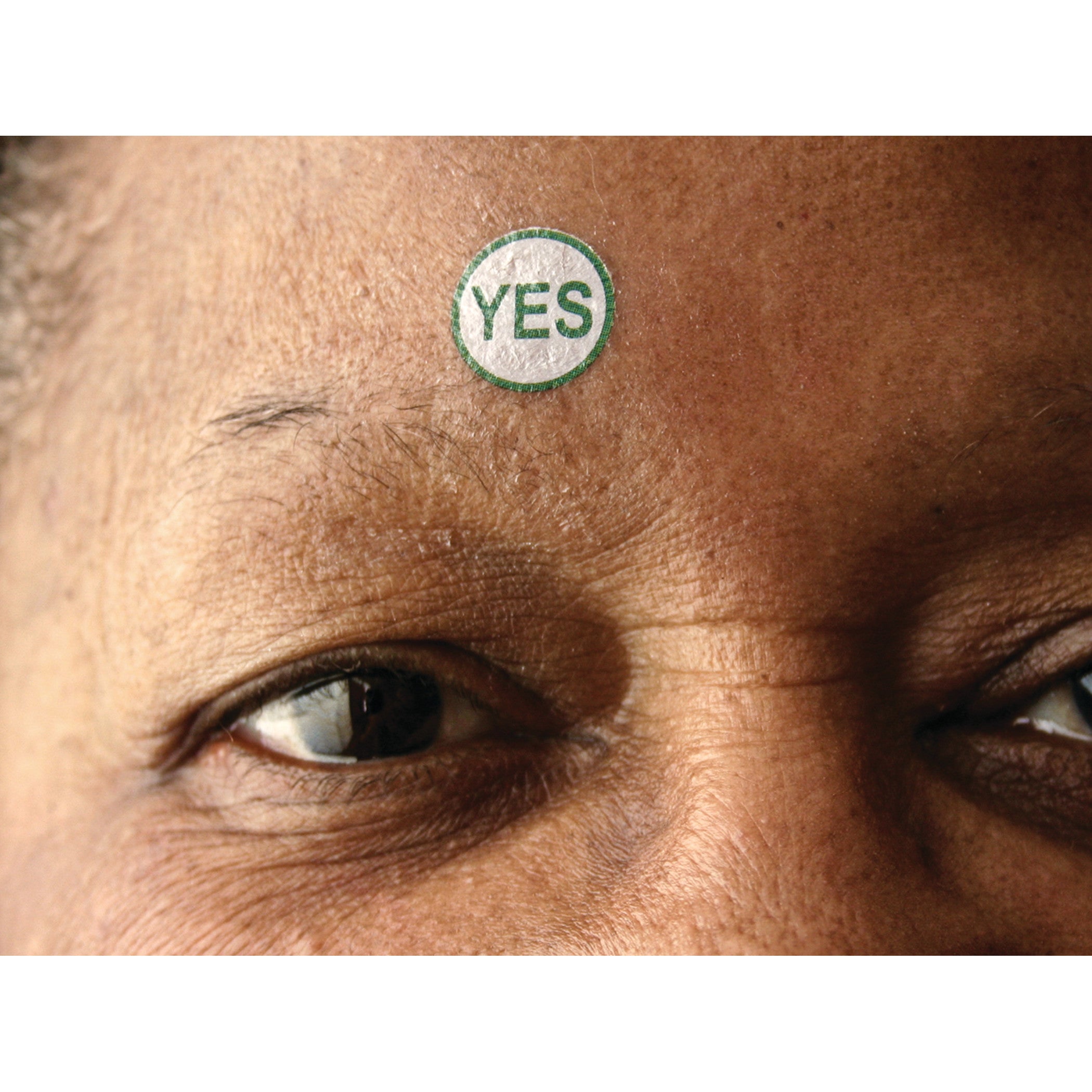 Close-up of a person's forehead with a Viscot TAT "YES" Marker sticker applied. The sticker is circular with "YES" in green text.