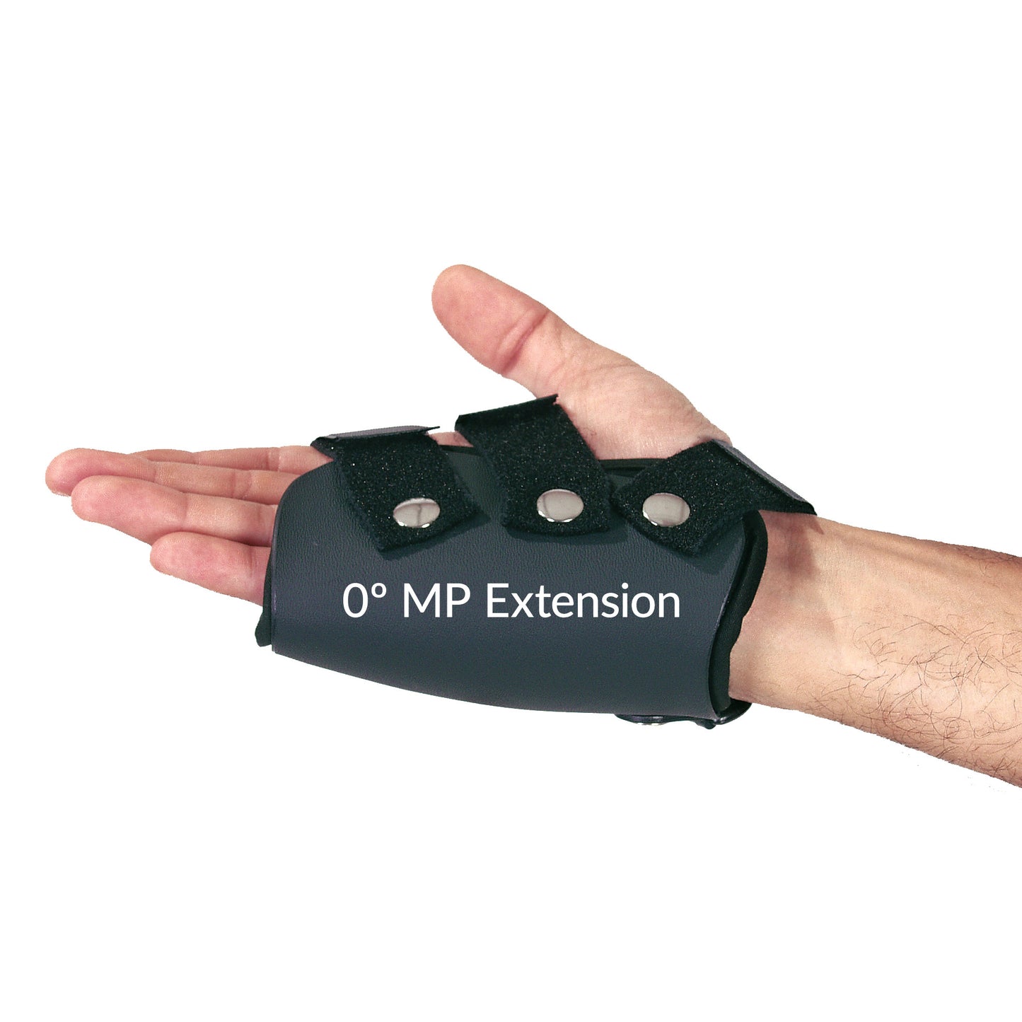 A person wears an AliMed FREEDOM comfort Boxer's Fracture Orthoses with MP Extension, secured by three adjustable straps and snaps.