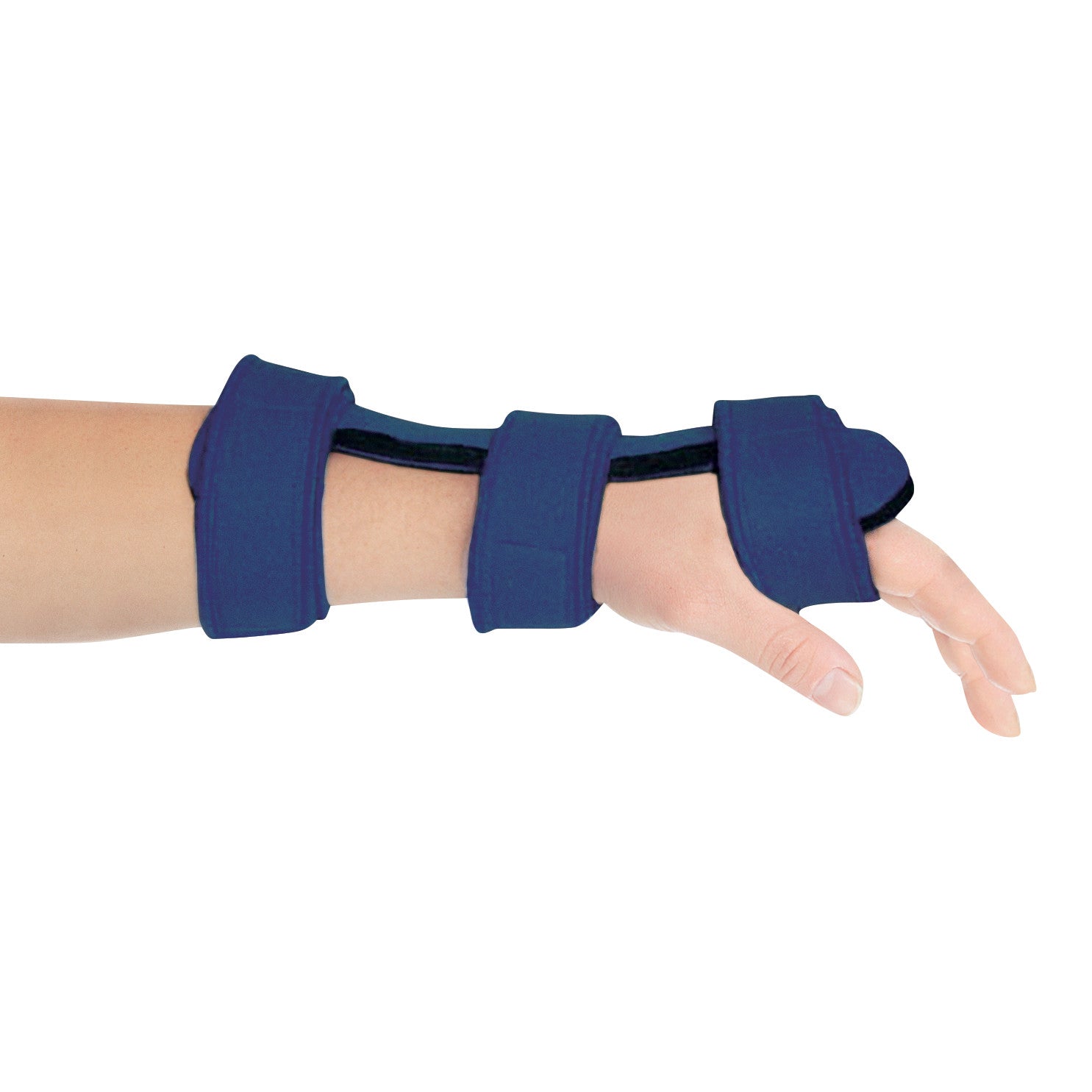 A person's hand and forearm in a Comfy Splints Adult Dorsal Hand Orthosis, featuring adjustable straps and a supportive design.