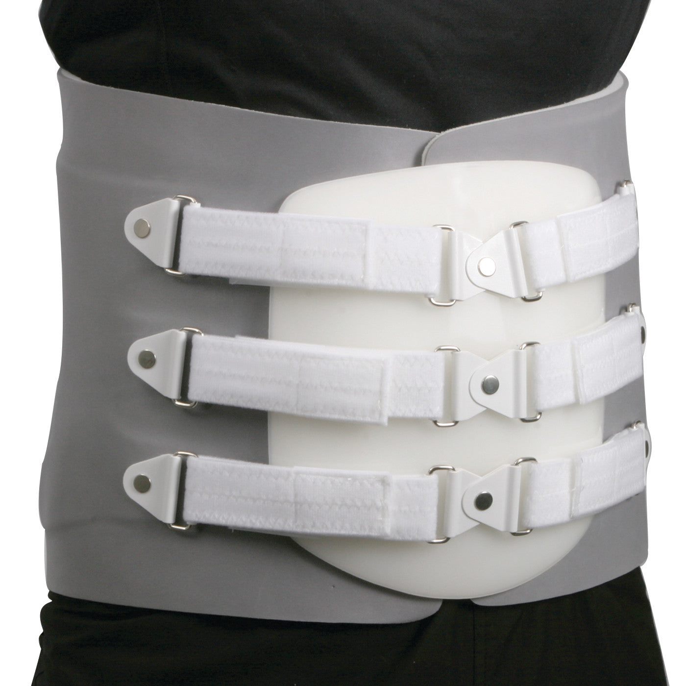 A person is wearing an AliMed TLSO brace with white straps and a plastic front panel for spinal support.