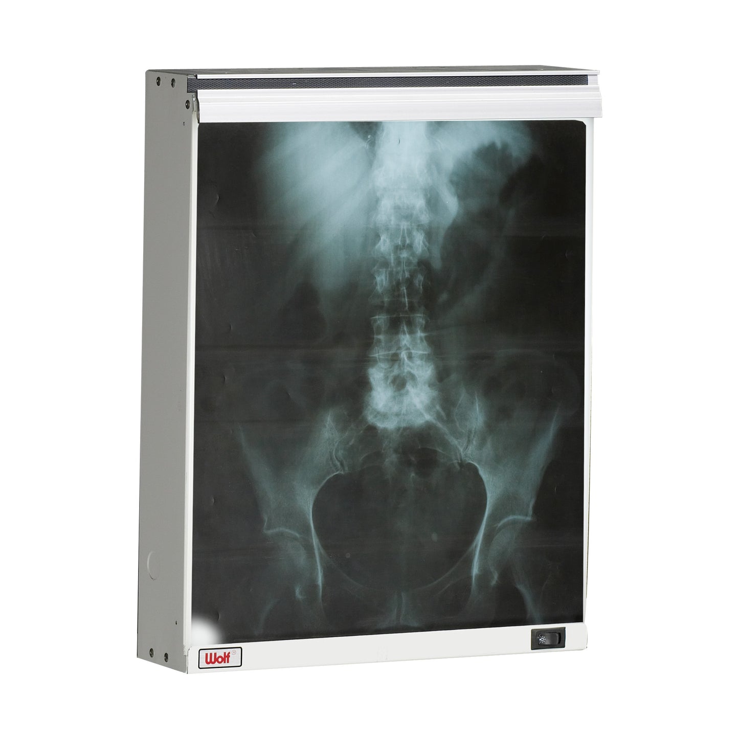 An X-ray image of a pelvis and spine is displayed on a Wolf Econoline Illuminator with a lighted background.