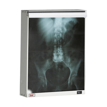 An X-ray image of a pelvis and spine is displayed on a Wolf Econoline Illuminator with a lighted background.