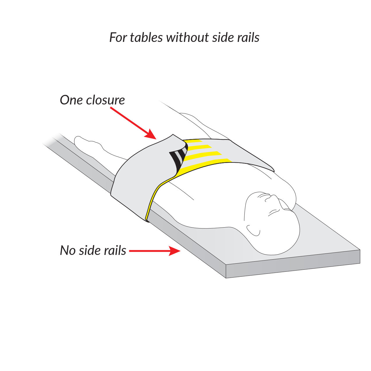 A patient lies on a table without side rails, secured by an AliMed Radiolucent Abdominal Immobilizer with One Closure.