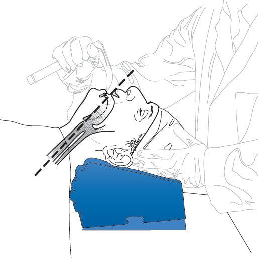 Illustration shows the PopitzPillow Supine Sniff Positioner supporting a person's head and neck during a medical procedure.