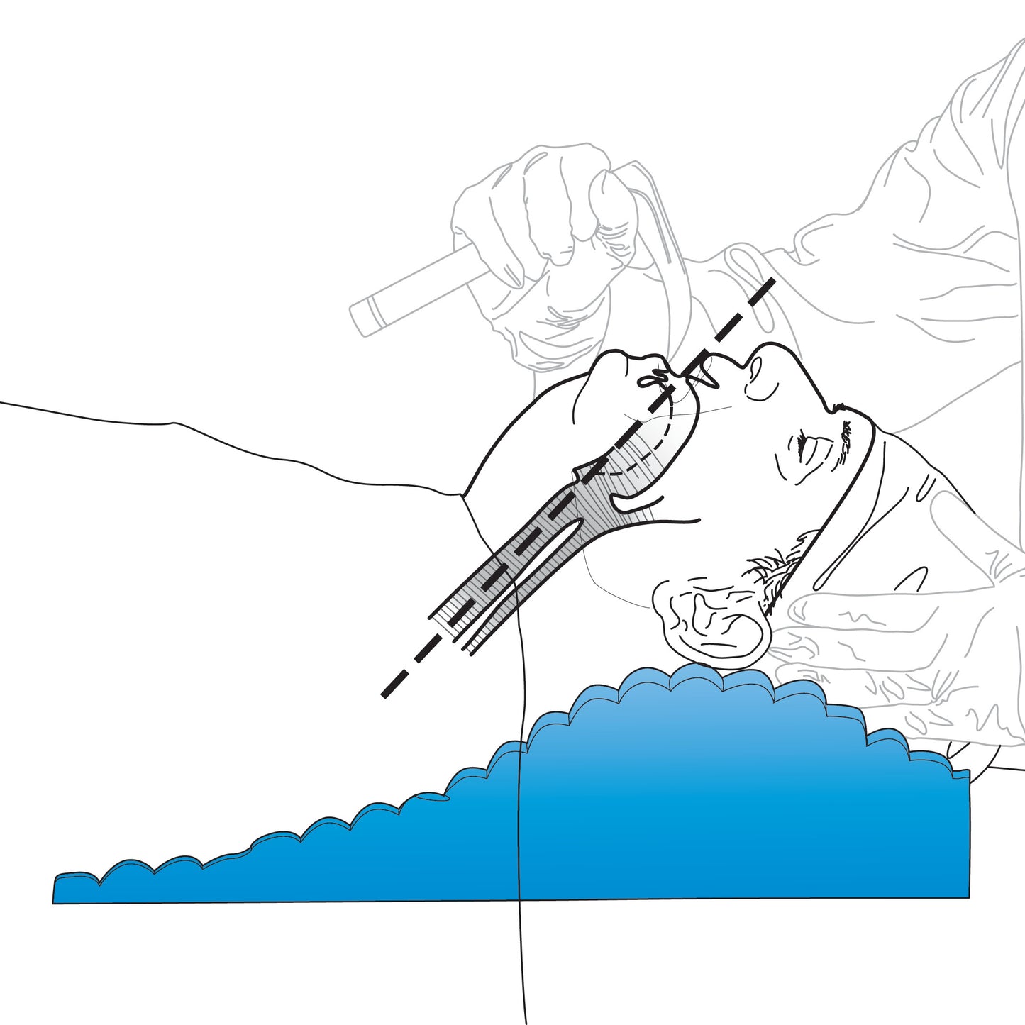 Illustration of the PopitzPillow Supine Sniff Positioner showing head elevation technique for airway management.
