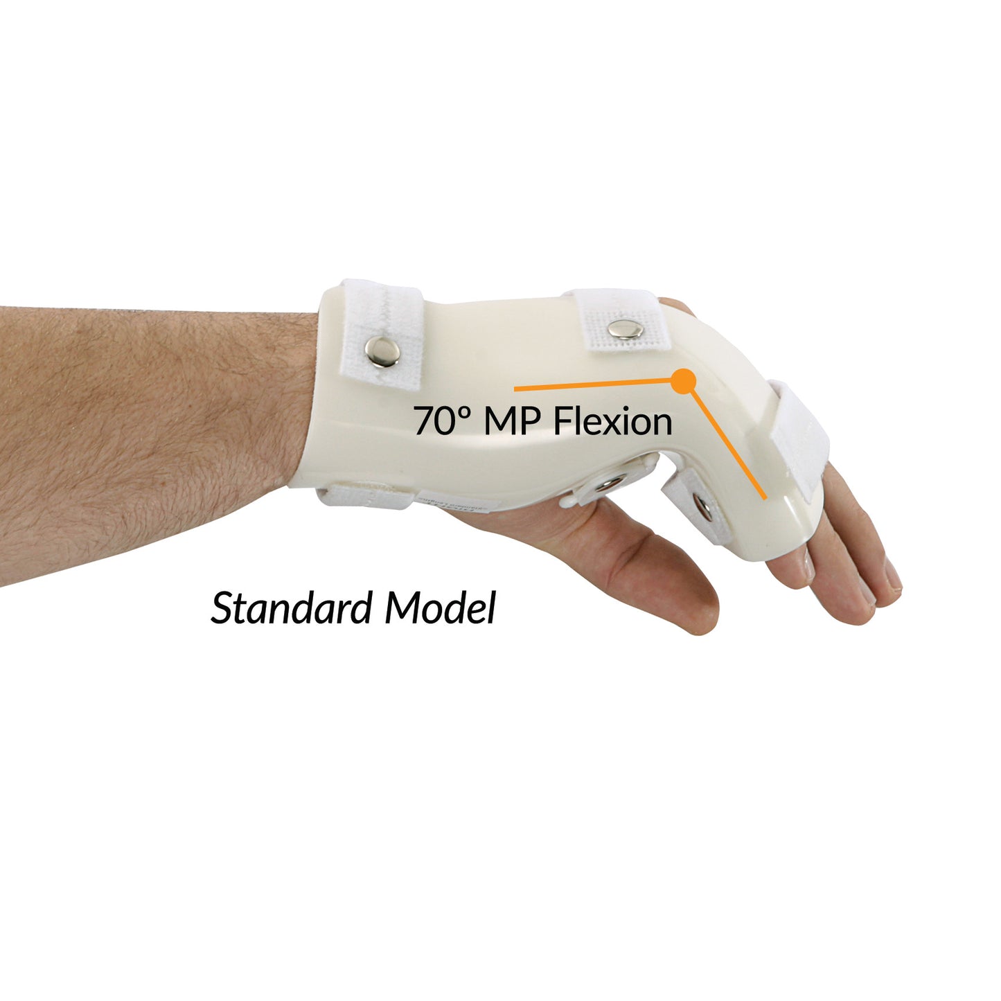 A hand wearing a G-Force Boxers Splint with MP Flexion, showing a 70 1/2 MP flexion angle